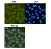 ICC/IF testing of HeLa cells, fixed fixed by anhydrous methanol at -20oC, with FAK antibody at 1:200.