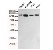 Western blot testing of monkey COS7, human HUVEC, human A549 and human HeLa cell lysates with FAK antibody at 1:1000. FAK has numerous isoforms and is routinely observed in western blot between 80~125 kDa.