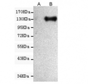 Western blot testing of A) untransfected and B) transfected CHO-K1 cells with CD133 antibody at 1:1000. Predicted molecular weight: ~97 kDa (unmodified), ~130 kDa (glycosylated).