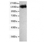 Western blot testing of human CaCo2 cell lysate with CD133 antibody at 1:1000. Predicted molecular weight: ~97 kDa (unmodified), ~130 kDa (glycosylated).