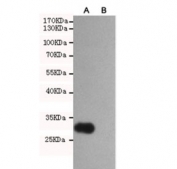 Western blot testing of A) transfected (human MMP2, partial) and B) untransfected CHO-K1 cell lysate with MMP2 antibody at 1:2000. Expected molecular weight of the partial protein: ~30 kDa.