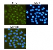 ICC/IF testing of HeLa cells, fixed fixed by anhydrous methanol at -20oC, with MMP2 antibody at 1:50. DAPI was used to stain nuclei (blue).