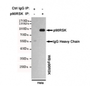 Immunoprecipitation of RSK1 from HeLa cell lysate, and subsequent western blot testing, using RSK1 antibody.