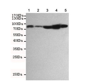 Western blot testing of 1) monkey COS7, 2) mouse NIH3T3, 3) human Jurkat, 4) human HeLa and 5) human A549 cell lysates using RSK1 antibody at 1:1000. Predicted molecular weight: 83-90 kDa.~