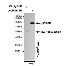Immunoprecipitation of RSK1 from HeLa cell ly