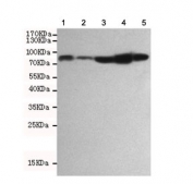 Western blot testing of 1) monkey COS7, 2) mouse NIH3T3, 3) human Jurkat, 4) human HeLa and 5) human A549 cell lysates using RSK1 antibody at 1:1000. Predicted molecular weight: 83-90 kDa.