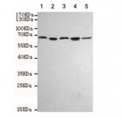Western blot testing of human 1) HeLa, 2) Ramos, 3) HepG2, 4) MCF7 and 5) Jurkat cell lysates using AIF antibody at 1:1000. Predicted molecular weight ~67 kDa.
