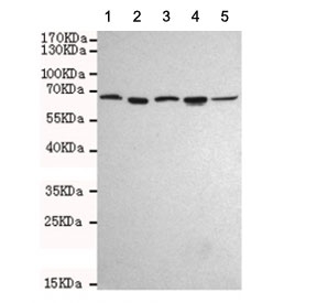 Western blot testing of human 1) HeLa, 2) Ramos, 3) HepG2, 4) MCF7 and 5) Jurkat cell lysates using AIF antibody at 1:1000. Predicted molecula