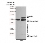 Immunoprecipitation of Vimentin from HeLa cell lysate, and subsequent western blot testing, using Vimentin antibody.