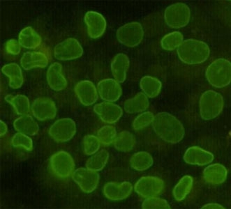 ICC/IF staining of HeLa cells, fixed with 4% Paraformaldehyde, using Lamin B1 antibody at 1:100.~