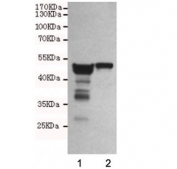 Western blot testing of 1) rat brain and 2) mouse brain lysates using Neuron Specific Enolase antibody at 1:1000. Predicted molecular weight ~47 kDa.