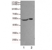 Western blot testing of human 1) SHSY-5Y and 2) U87-MG cell lysates using NSE antibody at 1:500. Predicted molecular weight ~47 kDa.