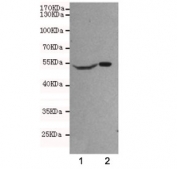 Western blot testing of human 1) SHSY-5Y and 2) U87-MG cell lysates using NSE antibody at 1:500. Predicted molecular weight ~47 kDa.
