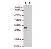 Western blot testing of TLR3 A) transfected and (B) untransfected CHO-K1 cell lysate with TLR3 antibody at 1:1000. Expected molecular weight of the partial protein: ~50 kDa.