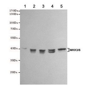 Western blot testing of 1) rat PC12, 2) rat C6, 3) human Ramos, 4) human Jurkat and 5) human HeLa cell lysates using MKK3/6 antibody at 1:1000. Predicted molecular weight: 39 kDa (MKK3) and 37 kDa (MKK6).~