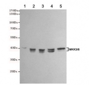 Western blot testing of 1) rat PC12, 2) rat C6, 3) human Ramos, 4) human Jurkat and 5) human HeLa cell lysates using MKK3/6 antibody at 1:1000. Predicted molecular weight: 39 kDa (MKK3) and 37 kDa (MKK6).
