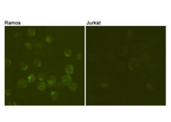 ICC/IF testing of Ramos cells (positive cell line, left) and Jurkat cells (negative cell line, right) using CD19 antibody at 1:100.~