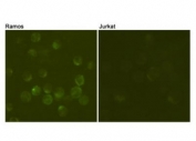 ICC/IF testing of Ramos cells (positive cell line, left) and Jurkat cells (negative cell line, right) using CD19 antibody at 1:100.