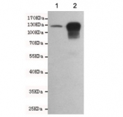 Western blot testing of 1) mouse embryo and 2) human HCT116 cell lysates using E-Cadherin antibody. Expected molecular weight: 135 kDa (precursor), 80-120 kDa (mature, depending on gylcosylation level).