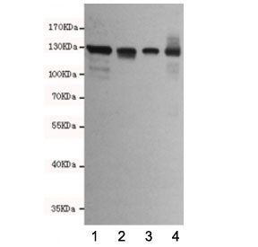 Western blot testing of human 1) T47D, 2) HCT116, 3) MDA-MB-468 and 4) Caco-2 cell lysates using E-Cadherin antibody at 1:2000. Expected molecular weight: 135 kDa (precursor), 80-120 kDa (mature, depending on gylcosylation level).~
