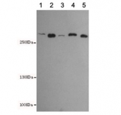 Western blot testing of 1) human HeLa, 2) rat C6, 3) NIH3T3, 4) monkey CHO-K1 and 5) MCF7 cell lysates using FASN antibody at 1:500. Expected molecular weight ~270 kDa.