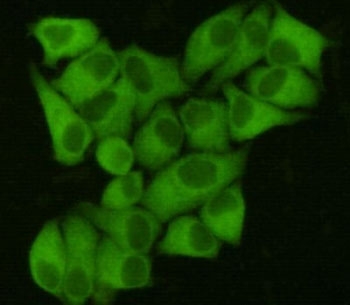 ICC/IF staining of HeLa cells, fixed with 4% Paraformaldehyde, using FASN antibody at 1:200.