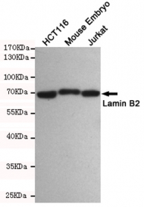 Western blot testing of 1) human HCT116, 2) mouse embryo and 3) human Jurkat cell lysates using Lamin B2 antibody at 1:500. Predicted molecular weight ~70 kDa.~
