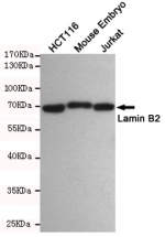 Western blot testing of 1) human HCT116, 2) mouse embryo and 3) human Jurkat cell lysates using Lamin B2 antibody at 1:500. Predicted molecular weight ~70 kDa.