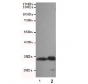 Western blot testing of human 1) HeLa and 2) K562 cell lysates using CDK4 antibody at 1:500. Predicted molecular weight ~34 kDa.