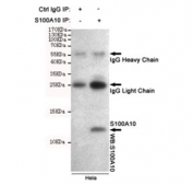 Immunoprecipitation of S100A10 from HeLa cell lysate, and subsequent western blot testing, using S100A10 antibody.