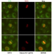 ICC/IF analysis of HeLa cells, fixed fixed by anhydrous methanol at -20oC, using SIRT2 antibody at 1:50 (green) and Histone H3.1 (pSer10) antibody at 1:200 (red).