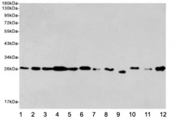 Western blot testing of human 1) Jurkat, 2) HeLa, 3) MCF7, 4) K562, 5) rat C6, 6) mouse NIH3T3, 7) rat PC12, 8) human HepG2, 9) hamster CHO-K1, 10) human Raji, 11) mouse Raw264.7 and 12) human Ramos cell lysates using EIF4E antibody at 1:2000. Predicted molecular weight ~27 kDa.~