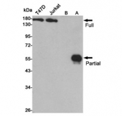Western blot testing of lysates from human T47D, Jurkat, untransfected CHO-K1(B) and CHO-K1 transfected with an HDAC6 fragment (A) using HDAC6 antibody at 1:1000. Predicted molecular weight: 130-160 kDa (full length), ~55 kDa (partial).