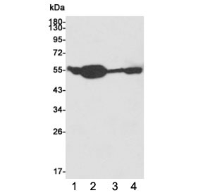 Western blot testing of 1) huma HCT116, 2) rat brain, 3) human K562 and 4) rat C6 cell lysates using ATG5 antibody at 1:1000. Predicted molecular weight ATG5: ~32 kDa; ATG5/ATG12 heterodimer: ~56 kDa.~