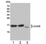 Western blot testing of 1) rat cerebral cortex, 2) rat brain and 3) human HeLa cell  lysates using LC3A/B antibody at 1:1000. Predicted molecular weight: ~14 kDa (LC3A) and ~15 kDa (LC3B).