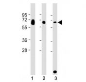 Western blot testing of GGT3P antibody at 1:2000: Lane 1) human ovary, 2) human testis and 3) rat kidney lysate. Predicted molecular weight ~62 kDa.