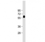 Western blot testing of GGT3P antibody at 1:2000 + human kidney lysate. Predicted molecular weight ~62 kDa.