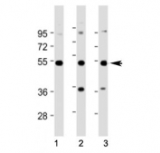 Western blot testing of STK25 antibody at 1:2000: Lane 1) human A431 cell lysate, 2) human HepG2 cell lysate and 3) human testis lysate. Predicted molecular weight ~48 kDa.