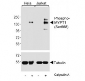 Western blot analysis of lysates from human HeLa and Jurkat cell lines, untreated or treated with Calyculin A (100nM), using phospho-MYPT1 antibody (upper) or Tubulin Ab (lower).