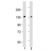 Western blot testing of MYPT1 antibody at 1:4000: Lane 1) mouse C2C12 and 2) mouse NIH3T3 cell lysate. Predicted molecular weight: 110~130 kDa.
