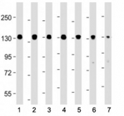 Western blot testing of Myosin Phosphatase antibody at 1:4000: Lane 1) human HEK293, 2) (h) HeLa, 3) (h) HT-29, 4) (h) MCF-7, 5) mouse C2C12, 6) (m) NIH3T3 and 7) (m) uterus lysate. Predicted molecular weight ~115 kDa.