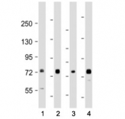 Western blot testing of TAK1 antibody at 1:1000-1:2000: Lane 1) human 293, 2) (h) A431, 3) (h) Raji and 4) mouse NIH3T3 cell lysate. Predicted molecular weight: 64-69 kDa, routinely observed at 78-82 kDa.