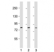 Western blot testing of TLR2 antibody at 1:500: Lane 1) human Ramos, 2) A549 and 3) MDA-MB-231 cell lysate. Predicted molecular weight: 85-90 kDa.