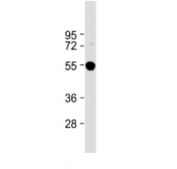 Western blot testing of FADS2 antibody at 1:2000 + human liver lysate. Predicted molecular weight ~52 kDa.