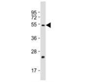 Western blot testing of FADS2 antibody at 1:2000 + human liver lysate. Predicted molecular weight ~52 kDa.