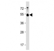 Western blot testing of BMP15 antibody at 1:4000 + human testis lysate. Routinely observed molecular weight: ~50 kDa pro form and 16-17 kDa mature form.