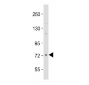 Western blot testing of Raf1 antibody at 1:2000 + human MCF7 cell lysate. Predicted molecular weight ~73 kDa.