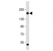 Western blot testing of THBS1 antibody at 1:2000 + human MDA-MB-231 cell lysate. Expected molecular weight ~130/155~200 kDa (unmodified/glycosylated).