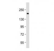 Western blot testing of Thrombospondin 1 antibody at 1:2000 + human MDA-MB-231 cell lysate. Expected molecular weight ~130/155~200 kDa (unmodified/glycosylated).