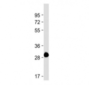 Western blot testing of ROS1 antibody at 1:4000 + partial recombinant protein. Predicted molecular weight ~264 kDa.
